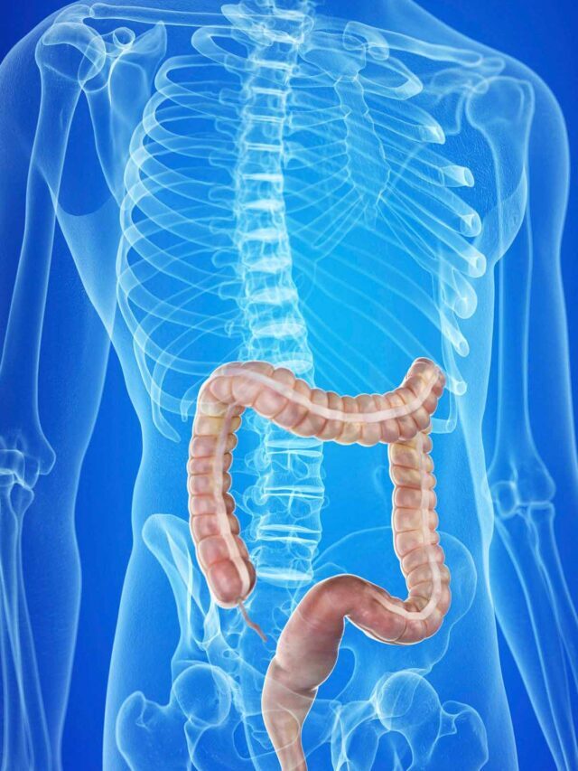 10  Best foods for colon health